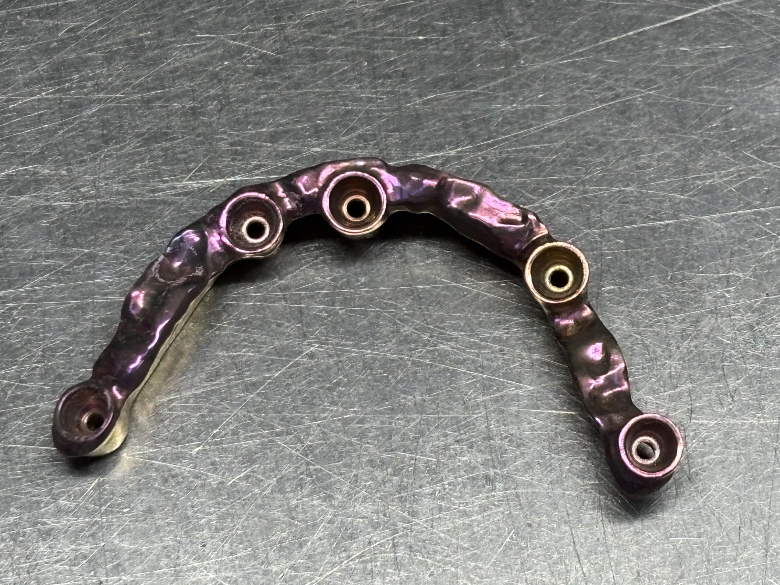 Armature titane anodisé rose pour bridge sur cinq implants dentaires.