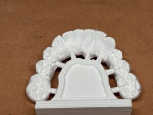 Prothèses dentaires en zircone à Carcassonne