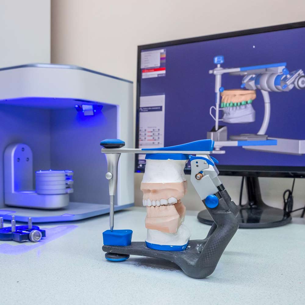 Technologie dentaire : articulateur et conception CAO 3D Articulateur dentaire avec modèle en plâtre devant un scanner et logiciel de conception CAO 3D.
